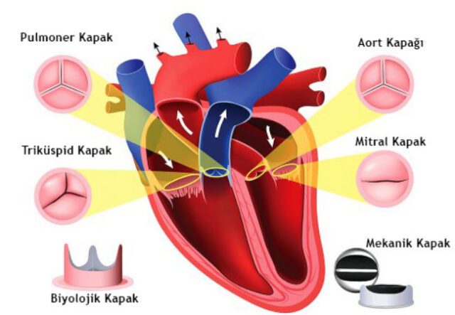 Mekanik ve Biyolojik Kalp Kapakçıkları