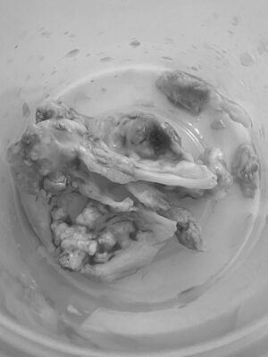 Kalsifik (kireçli) biküspit aort kapak