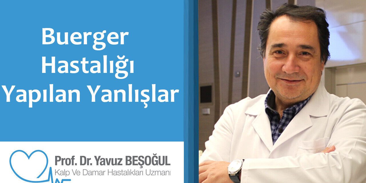 Buerger Hastalığın da Yapılan Yanlışlar