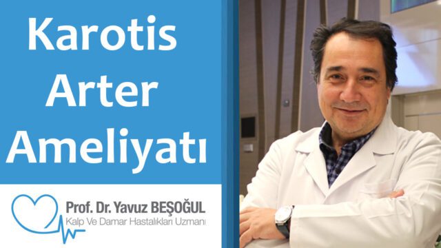 karotis arter ameliyatı