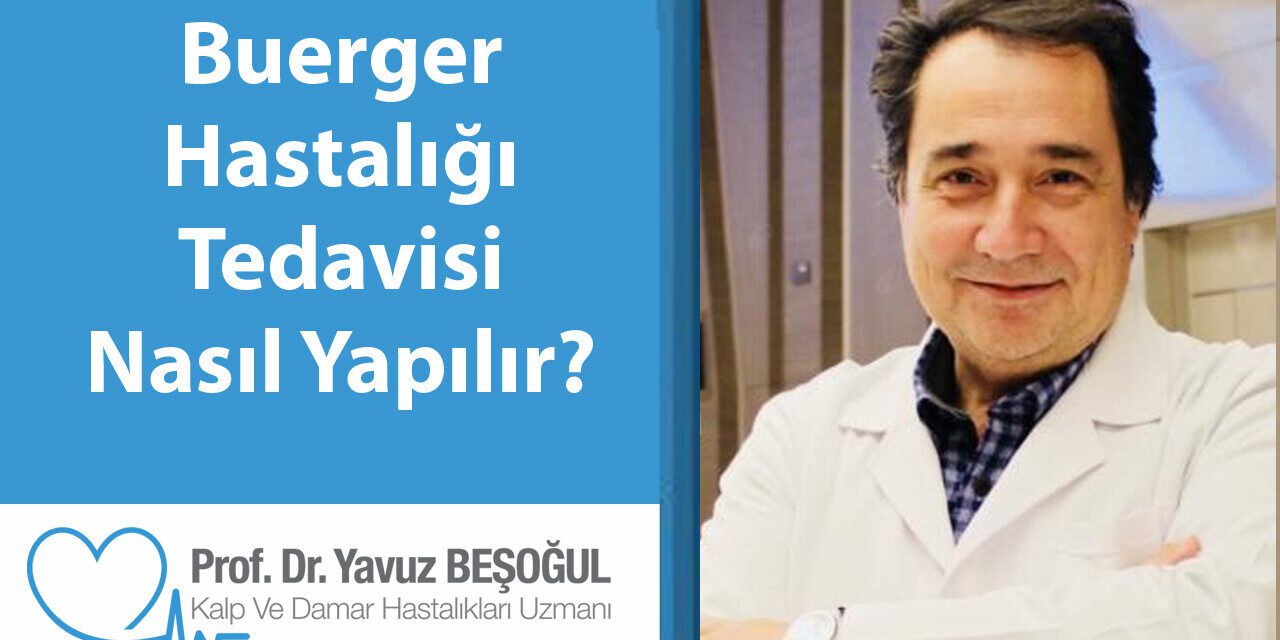 Buerger Hastalığı Tedavisi Nasıl Yapılır?