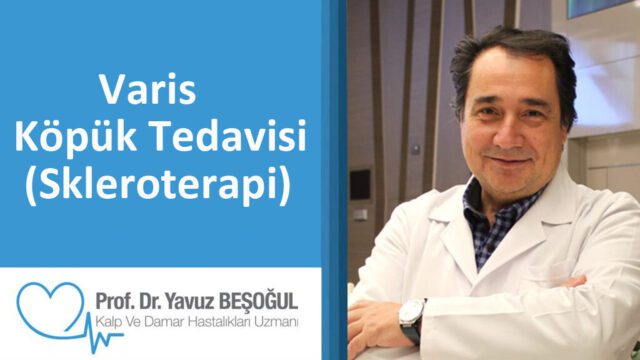 VARİS KÖPÜK TEDAVİSİ SKLEROTERAPİ
