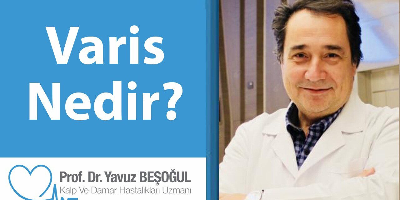 Varis Nedir?