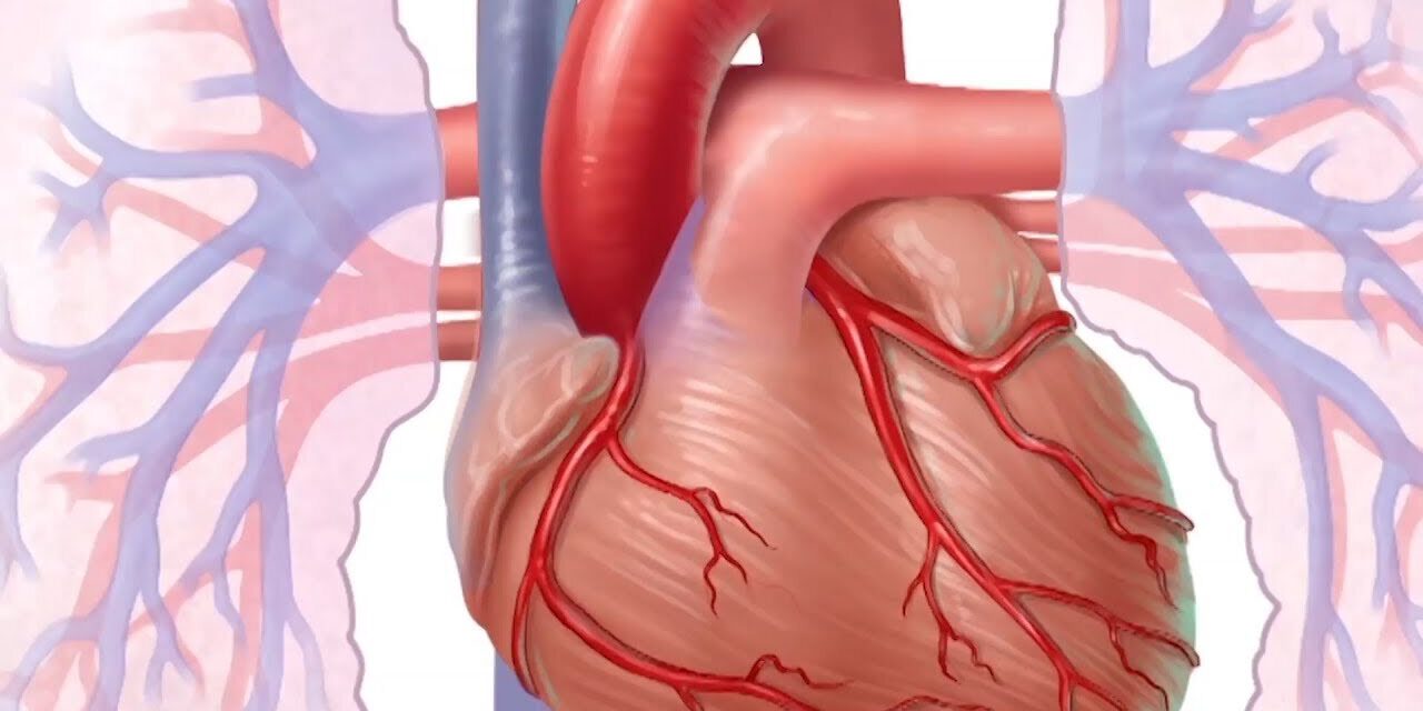 Coronary Artery Disease