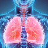 What is Pulmonary Embolism?