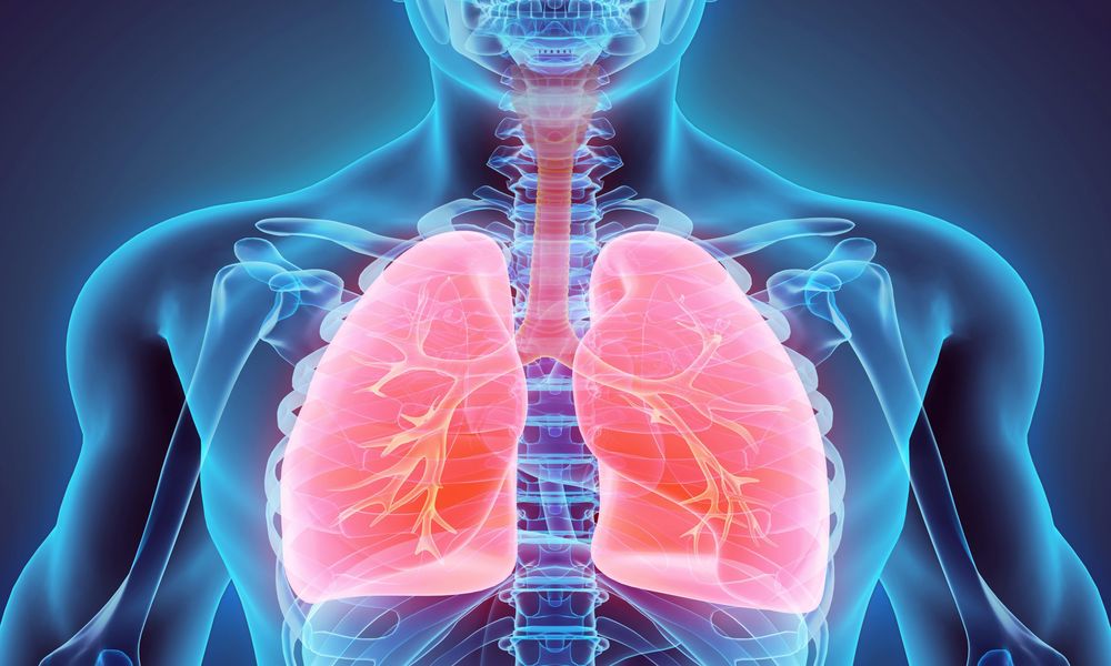 What is Pulmonary Embolism?