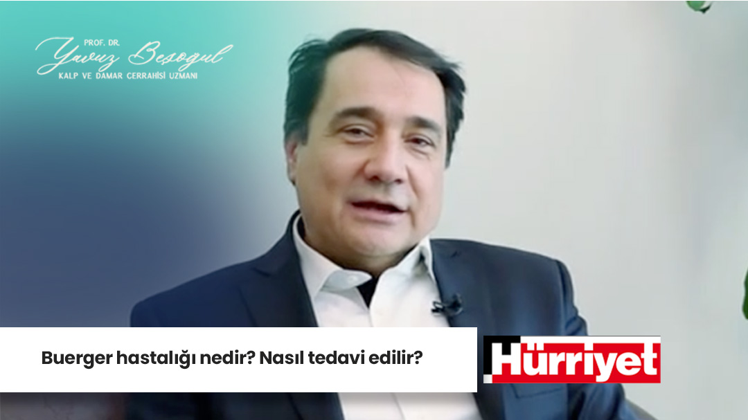 Buerger hastaligi nedir Nasil tedavi edilir 1