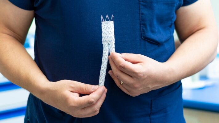 EVAR ve TEVAR Nedir Belirtileri ve Tedavi Yontemleri Nelerdir