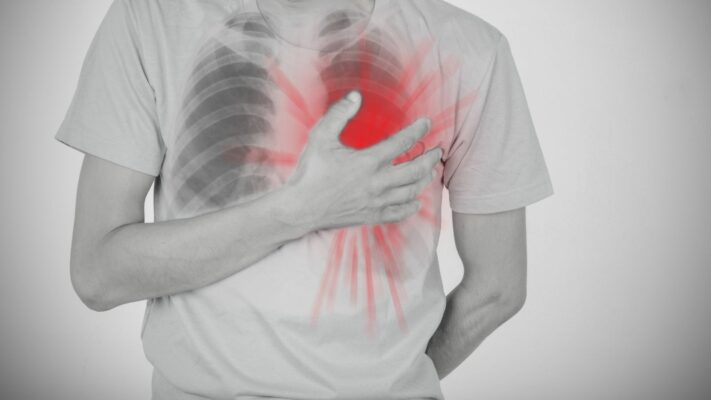 Gogus Kafesi Agrisi Nedenleri Teshis ve Tedavisi