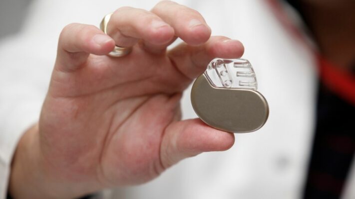 Kalp Pili Cikarilmasi Kalp Pili Neden ve Nasil Cikarilir