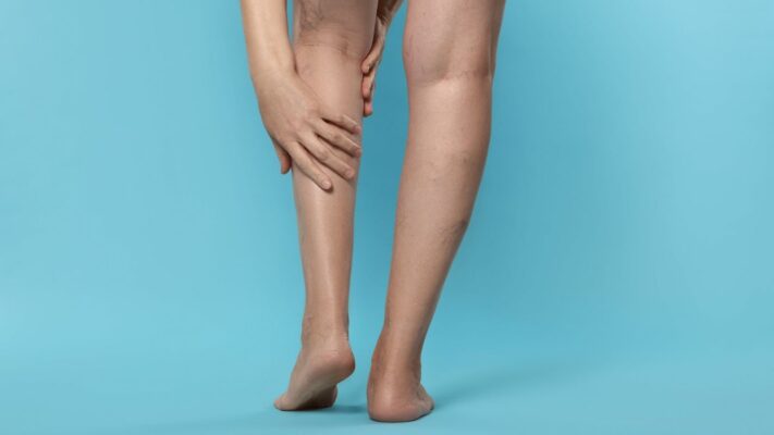 Bacakta Kan Dolasim Bozuklugu Belirtileri 1