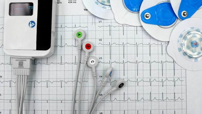 EKG Elektrokardiyogram Nedir Nasil Cekilir