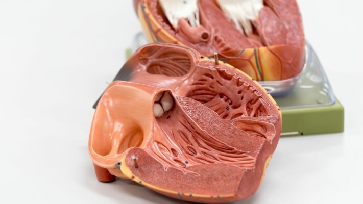 Patent Duktus Arteriosus PDA Nedir 1