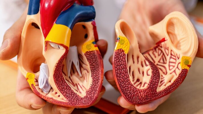 Patent Foramen Ovale PFO Nedir Tedavisi Nasildir