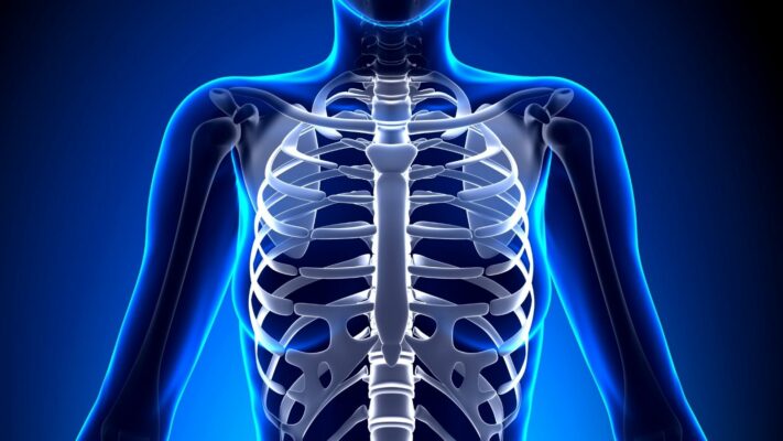 Torasik Outlet Cikis Sendromu Nedir Belirtileri ve Tedavisi