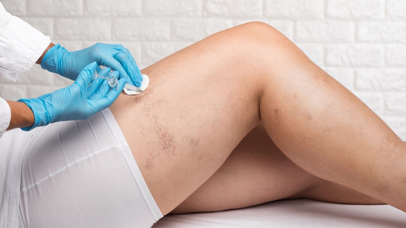 Varis Tedavisi Olanlarin Yorumlari Sikayetleri