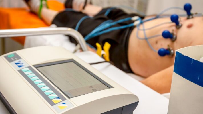 Kalp Damar Tikanikligi EKG Ile Anlasilir Mi Anjiyo Olmadan Belli Olur Mu