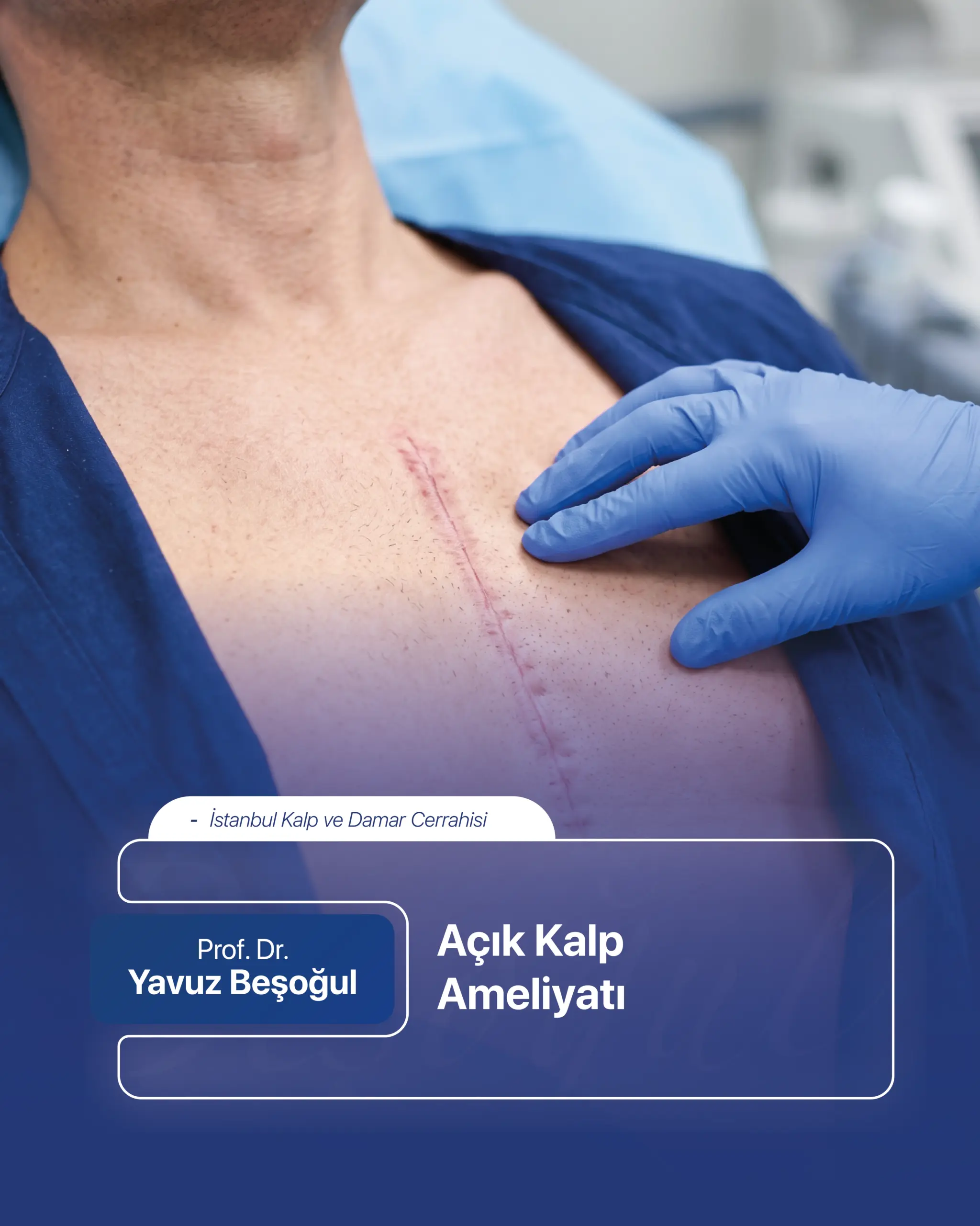 Açık Kalp Ameliyatı