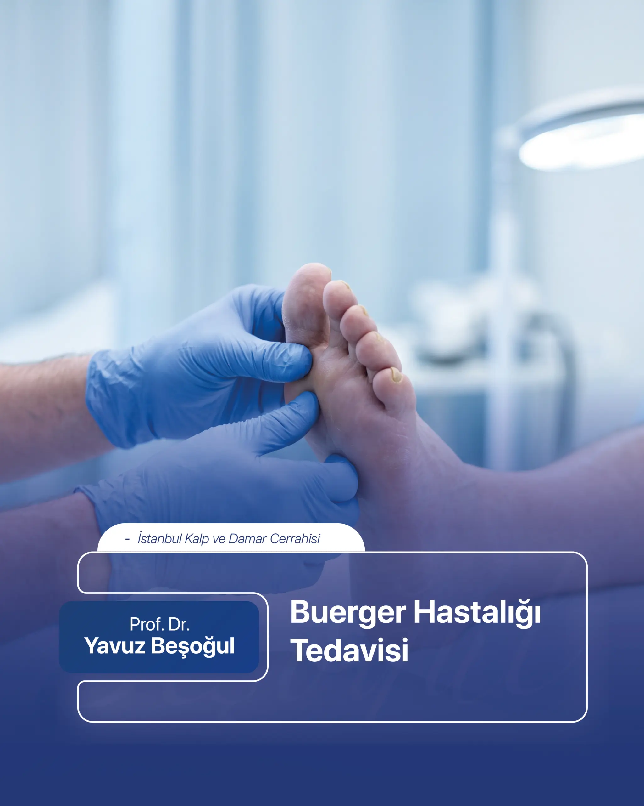 Buerger Hastalığı Tedavisi