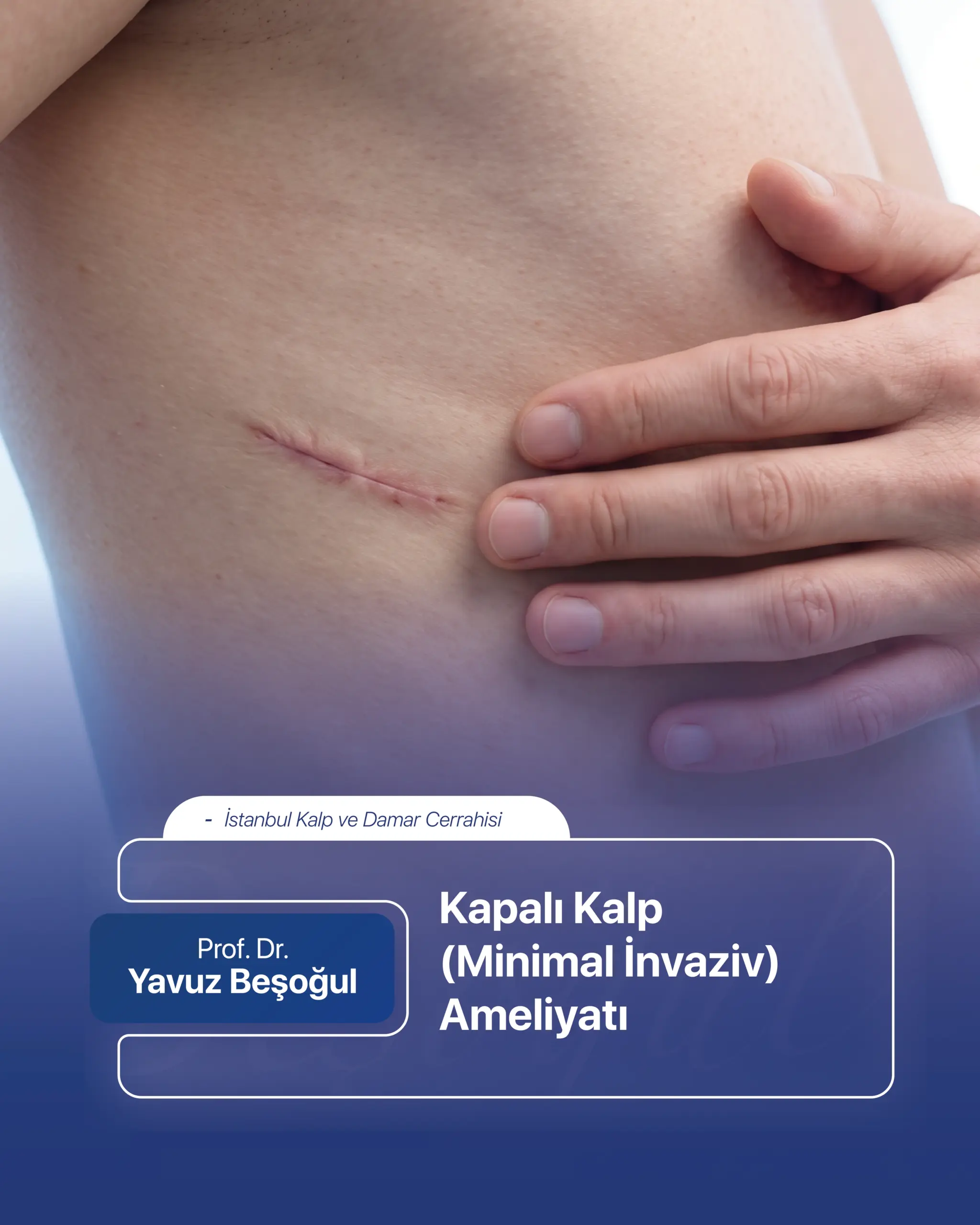 Kapalı Kalp (Minimal İnvaziv) Ameliyatı