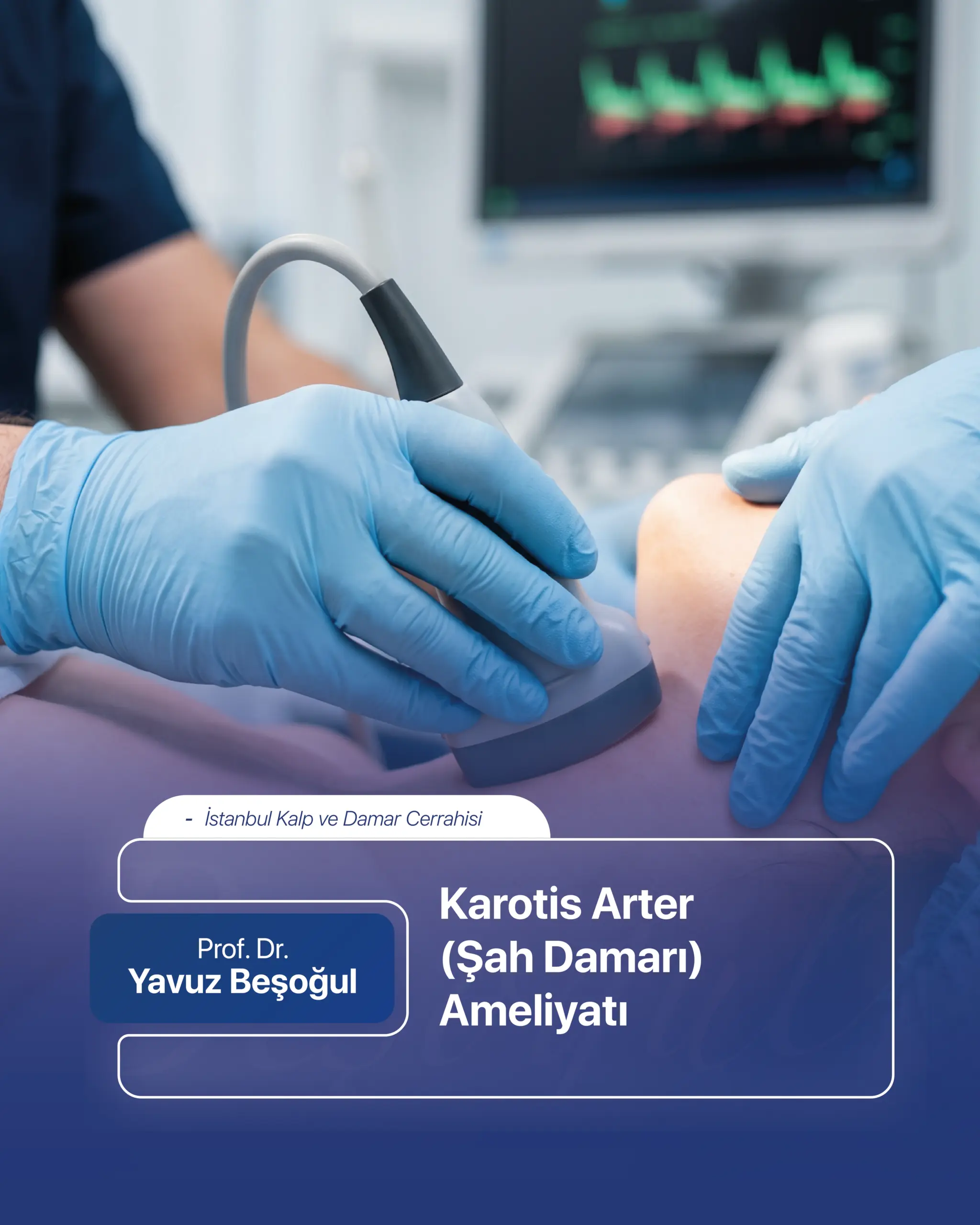 Karotis Arter (Şah Damarı) Ameliyatı