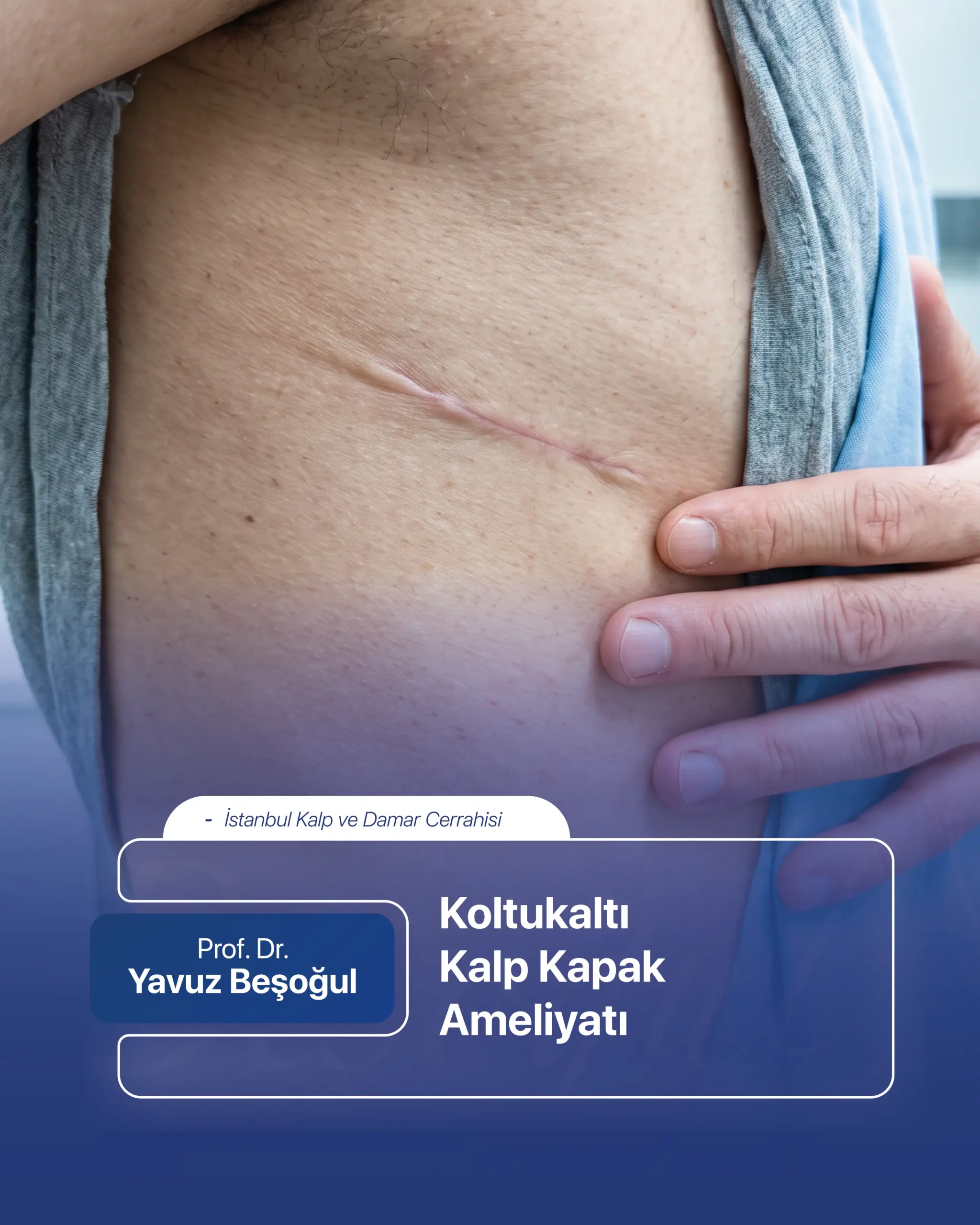 Koltukaltı Kalp Kapak Ameliyatı