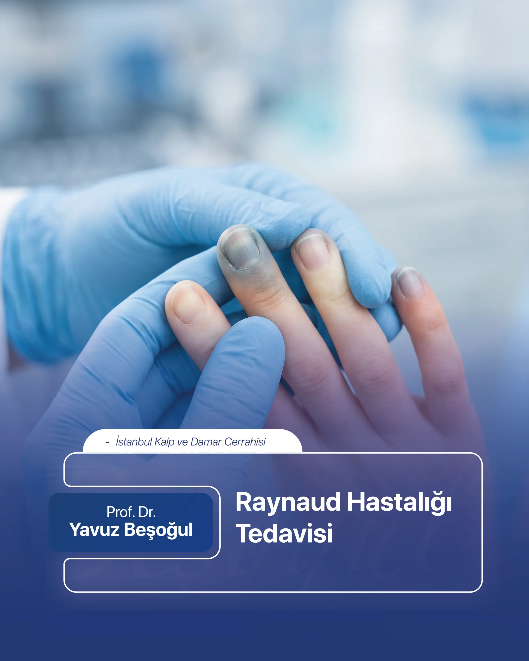 Raynaud Hastalığı Tedavisi